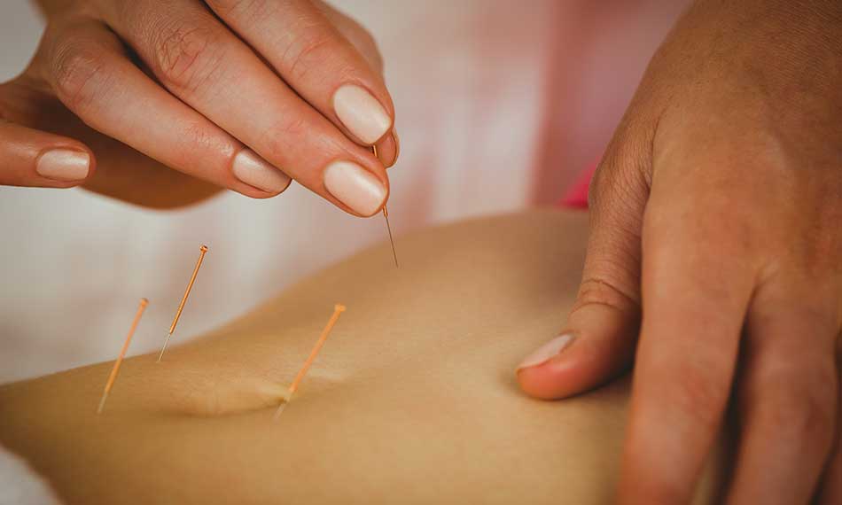 Fertility and Pregnancy Acupuncture