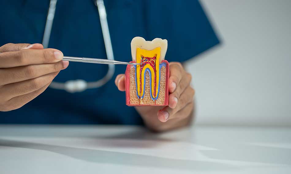 Root Canal Treatment