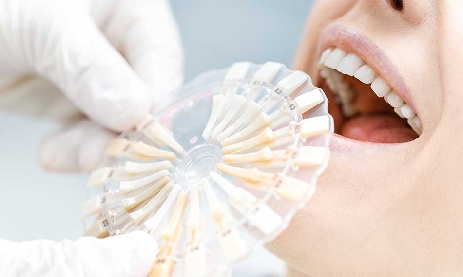 Cosmetic Dentistry (Whitening, Veneers)