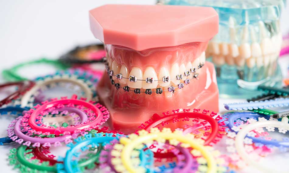 Orthodontics (Braces and Aligners)